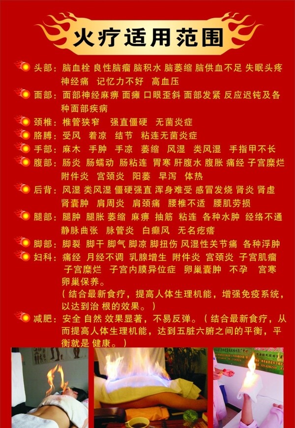 火療圖片