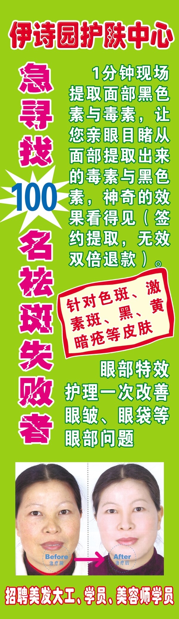 美容院祛斑海報(bào)圖片