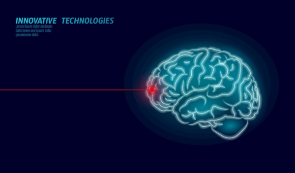 科技大脑