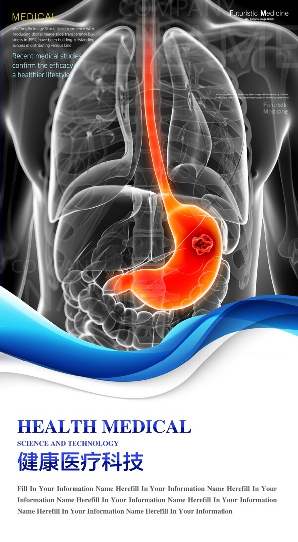 肠胃海报