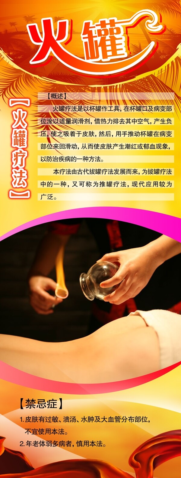 火罐圖片