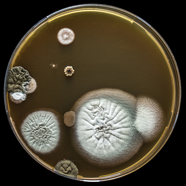 培养皿里的细菌图片