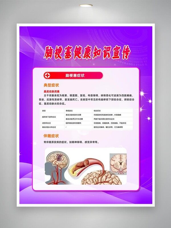 腦梗塞典型伴隨癥狀科普知識海報