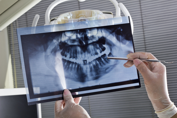 看X光片的牙科医生图片