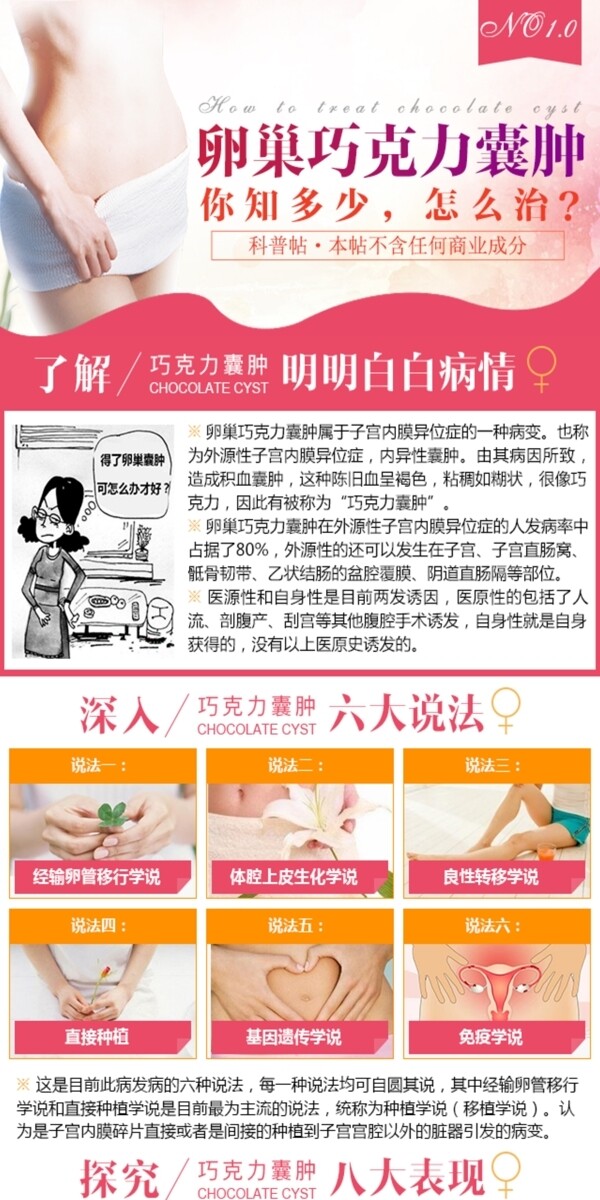 巧克力囊肿页面