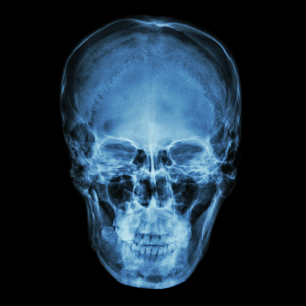 人的脸部X光片图片